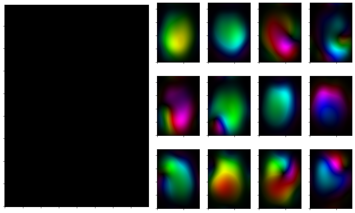 ../_images/notebooks_parallel_mri_21_0.png