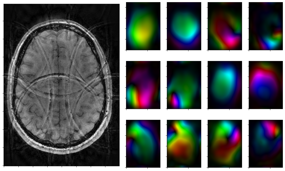 ../_images/notebooks_parallel_mri_21_2.png