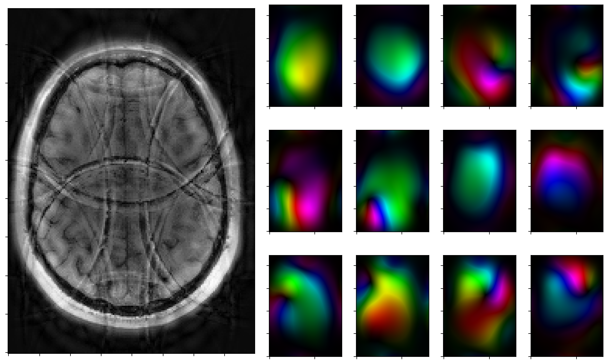 ../_images/notebooks_parallel_mri_21_3.png