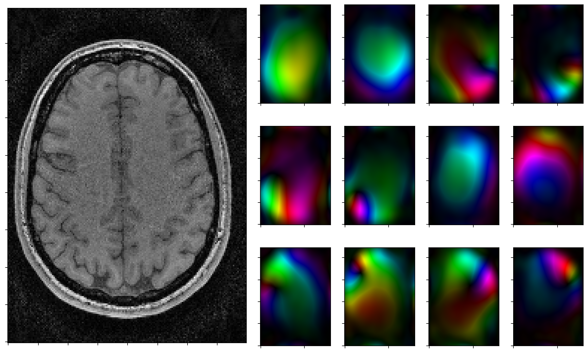../_images/notebooks_parallel_mri_21_4.png
