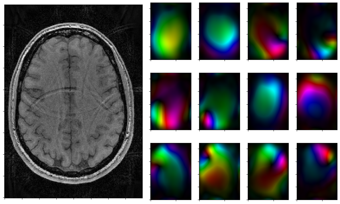 ../_images/notebooks_parallel_mri_21_7.png